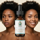 Before and after comparison of a woman's face using Aurelian House vitamin C.
