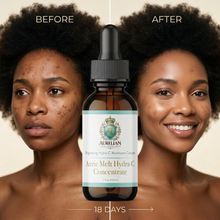 Before and after comparison of a woman's face using Aurelian House vitamin C.